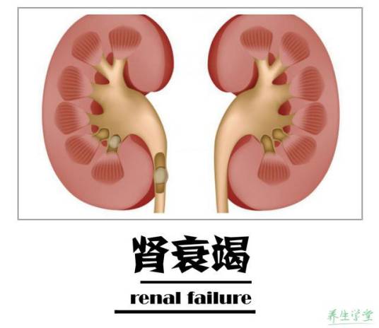 肾后性肾衰