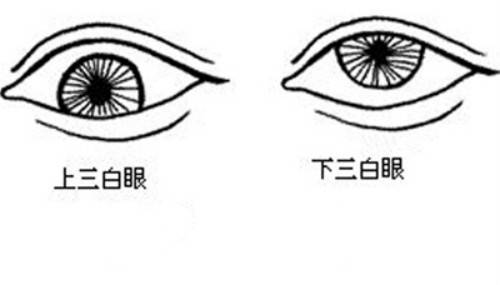 三白眼