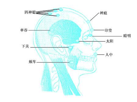 印堂(人体腧穴)