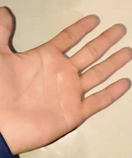 手心（身体部位）