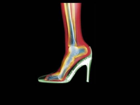 射线(物理化学词汇)