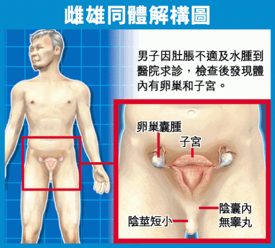 雌雄同体人