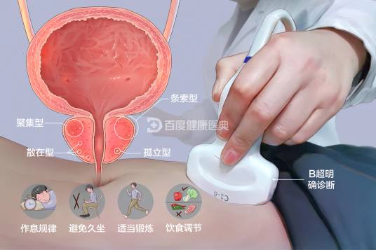 前列腺钙化