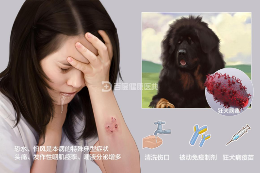 狂犬病(急性传染病)