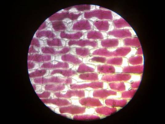 质壁分离（生物学词汇）