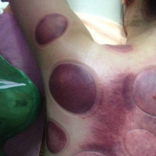 湿气（中医理论概念）