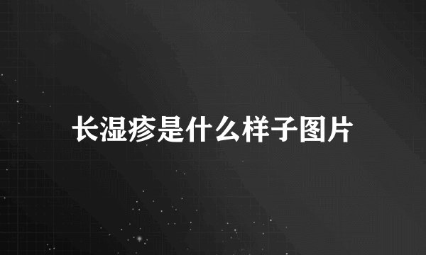 长湿疹是什么样子图片