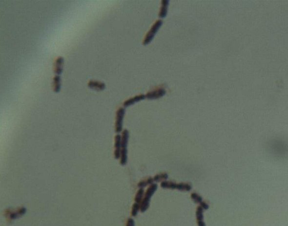 动物双歧杆菌和乳双歧杆菌是不是同一种细菌？