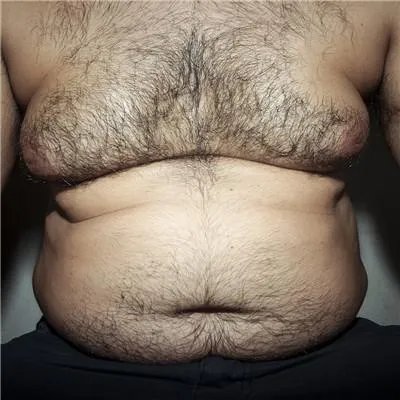 怎么不花钱减肥