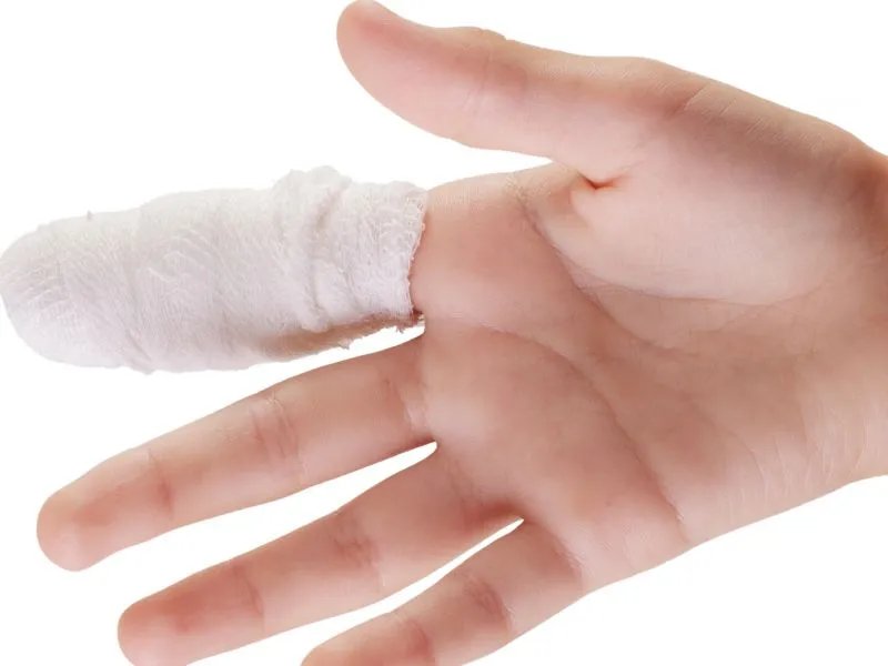 手指头断了怎么恢复