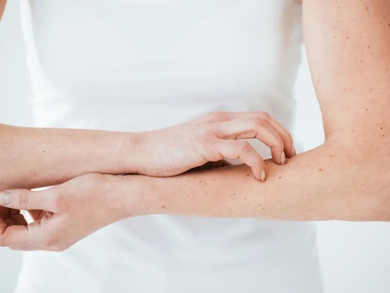 孕妇脸部过敏怎么办