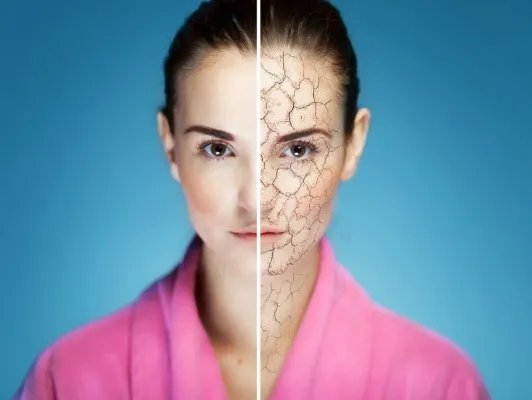 皮肤粗糙如何改善