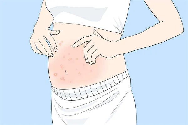 吃了紧急避孕药怀孕了怎么办