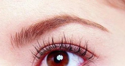 韩式埋线双眼皮的价位