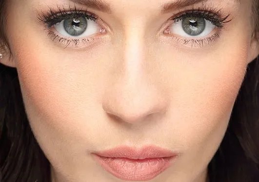 黑脸娃娃祛斑的费用要多少