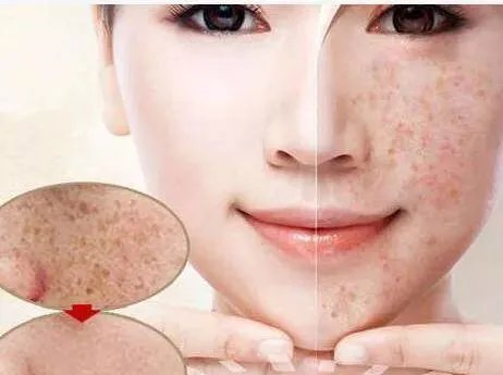 怎样辨别毒面膜?