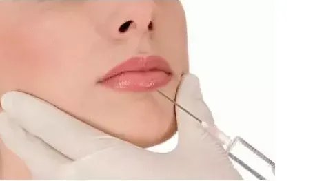 玻尿酸丰唇手术的价格