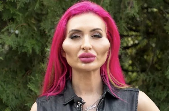 乌克兰网红自称拥有世界最大脸颊 五官违和还有点丑