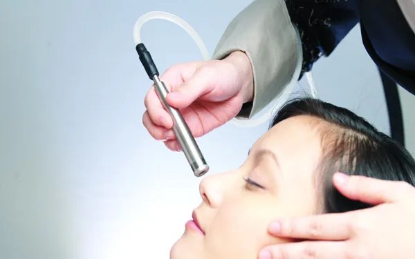 激光去除黑痣多少钱