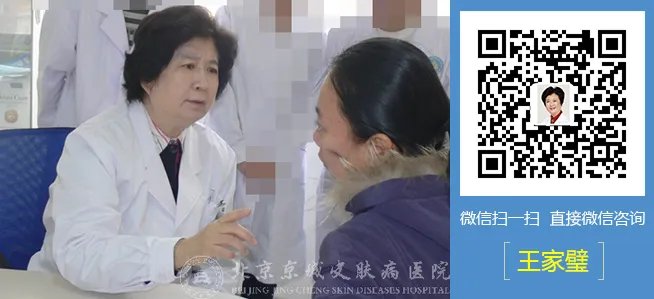 北京鱼鳞病治疗方法