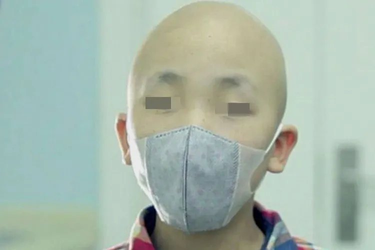 白血病早期图片