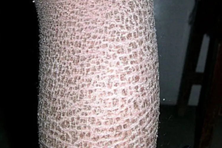 X连锁鱼鳞病小腿皮肤粗糙图片