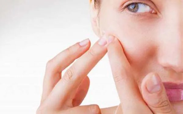 去除鱼尾纹要多少钱