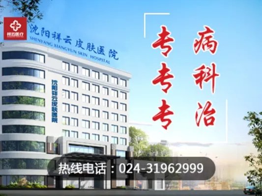 沈阳皮肤病专科医院【湿疹治疗医院】