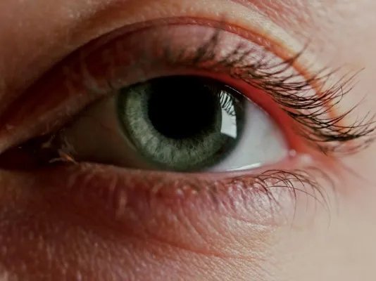 如何去眼角细纹