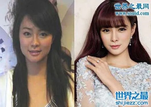 沈梦辰整容对比图，整容前后村姑变女神差太多 