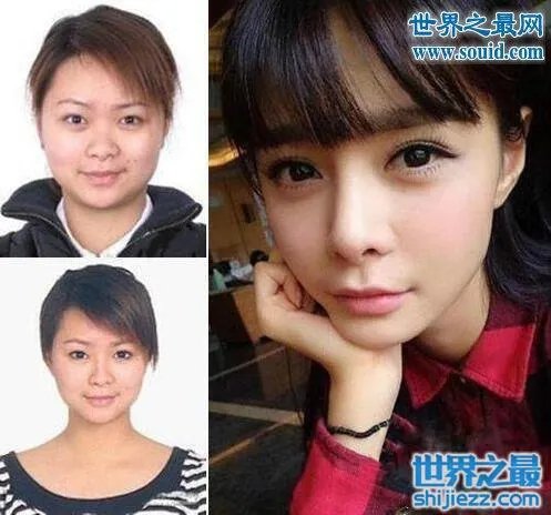 沈梦辰整容对比图，整容前后村姑变女神差太多 