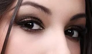 北京做双眼皮多少钱