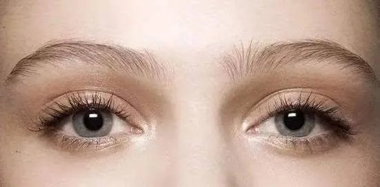 欧式双眼皮多少钱