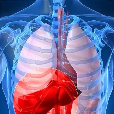 乙肝大三阳能治愈吗