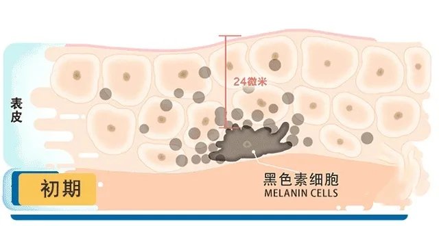 祛斑产品排行榜10强 祛斑用什么牌子护肤品好