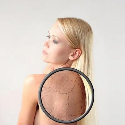 如何去痘印痘疤