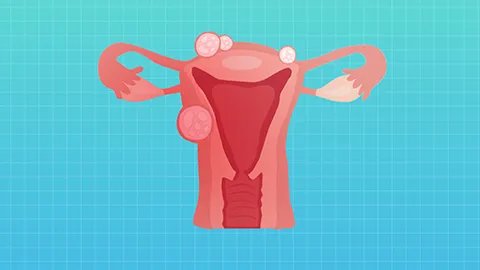 腹膜恶性间皮瘤是什么