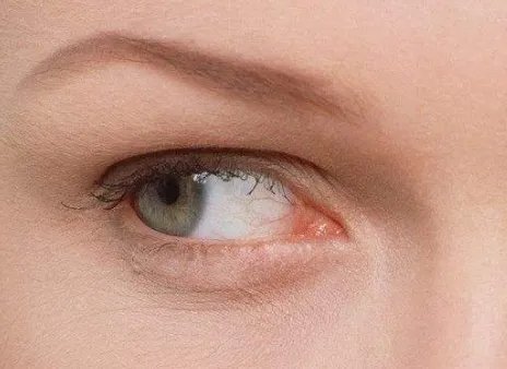 去下眼袋大概要多少钱