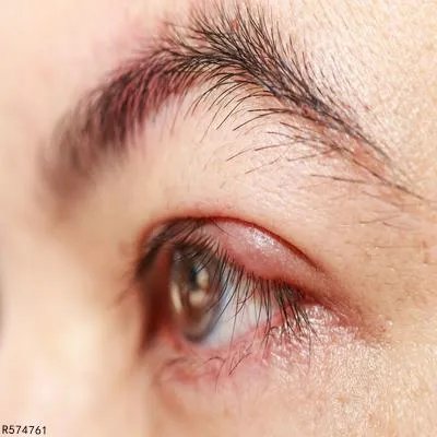 眼部除皱的方法有哪些 四个方法消除眼部皱纹