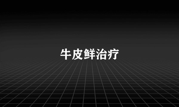 牛皮鲜治疗