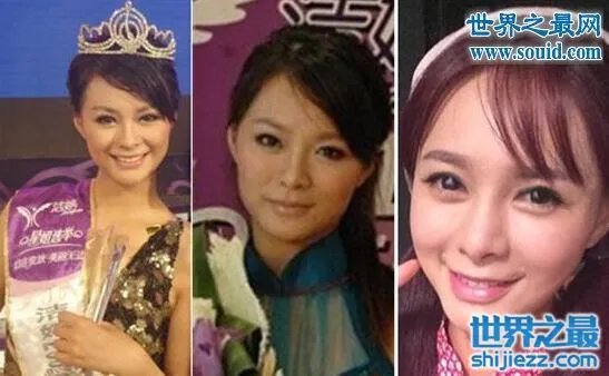 沈梦辰整容对比图，整容前后村姑变女神差太多 