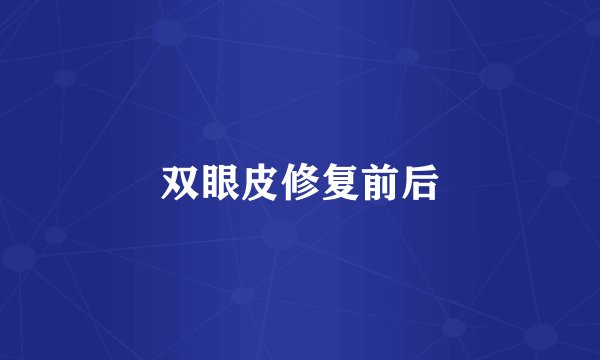 双眼皮修复前后