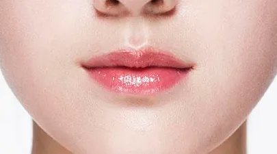 注射丰唇多少钱