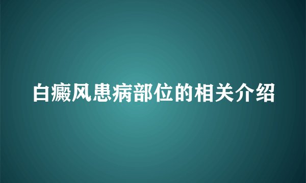 白癜风患病部位的相关介绍
